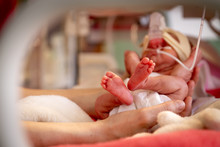 Bebés prematuros. Importancia de la estimulación temprana.